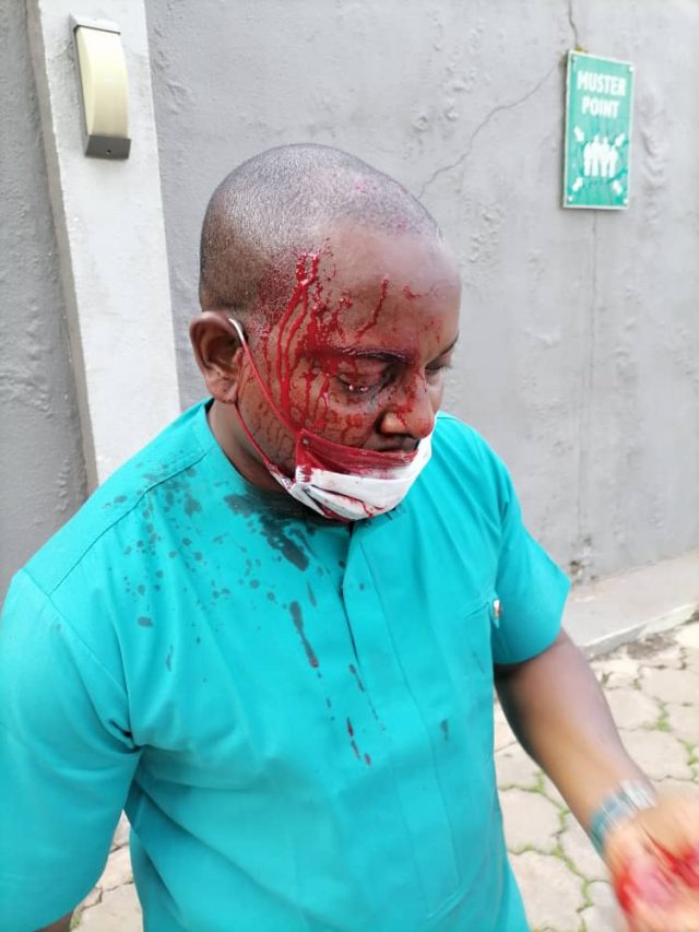 Why Enugu NMA election turned bloody IMG-20200807-WA0016-1-640×853